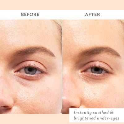 SKIN REMEDY SOOTHING EYE GELS