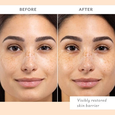 SKIN REMEDY BARRIER-BOOSING FACE MASK